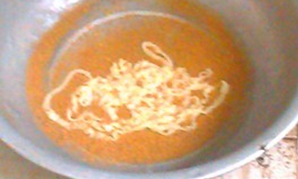 Kinh hoàng con sán khổng lồ trong bụng người