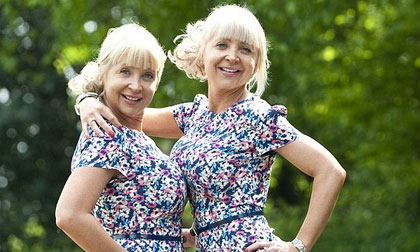 Cặp sinh đôi nghiện phẫu thuật thẩm mỹ để giống nhau như đúc