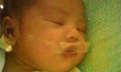 Bé 7 ngày tuổi bị y tá dán miệng vì khóc