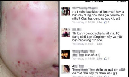 Hoang mang vì bức ảnh biến chứng khủng khiếp khi dùng mặt nạ ngủ Thái Lan giả