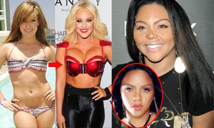 Nhưng vết tích "dao kéo" khó giấu của mỹ nhân thế giới