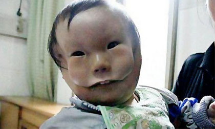 Cậu bé có miệng rộng đến mang tai