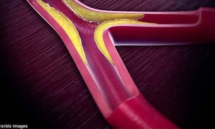 Thêm một nguyên nhân khó thụ thai bị nhiều người bỏ qua