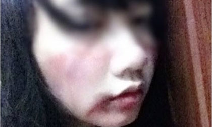 Lỡ miệng chửi thề, gái xinh bị "đầu gấu" đánh bầm mặt