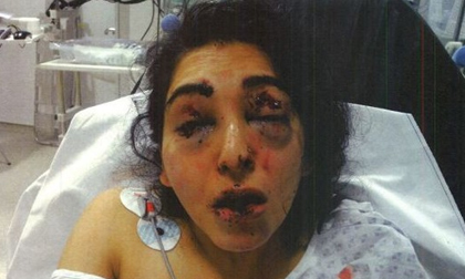 Bố chồng đâm mù mắt con dâu vì nghi ngoại tình