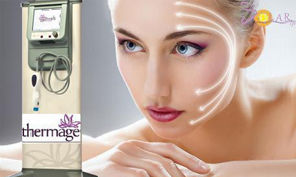 Giá "sốc" Thermage phiên bản mới căng da 1 lần duy nhất không phẫu thuật 