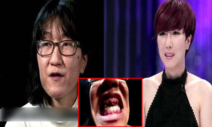 Cô gái bị gọi bằng "Bà" lột xác trẻ đẹp nhờ phẫu thuật thẩm mỹ