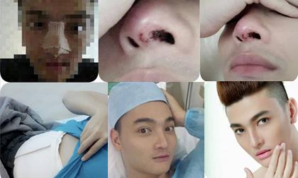 Hot boy của Phi Thanh Vân tung ảnh "dao kéo" cũ đau đớn