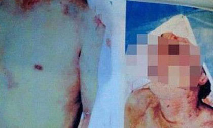 Phát hiện xác thanh niên có nghi vấn bị tra hỏi bức cung