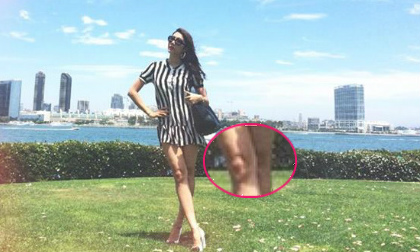 Ngọc Quyên mặc váy ngắn lộ đầu gối đen nhẻm