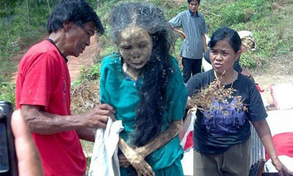 Chuyện khó tin về những thây ma "sống dậy", tự tìm đường về nhà