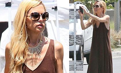 Xót xa nhìn sao Mỹ gầy như "bộ xương di động" trên phố