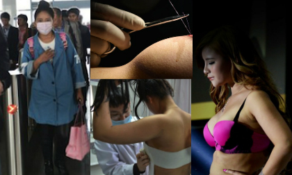 Cận cảnh quá trình nâng ngực của mẫu nữ 9x