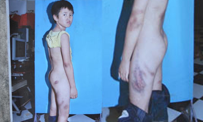 Mẹ kế hành hạ con riêng, chém chồng khâu 50 mũi