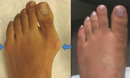 Những phương pháp phẫu thuật thẩm mỹ đáng sợ nhất của phái đẹp