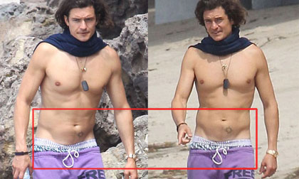 Orlando Bloom bị chê vô duyên vì mặc quần tụt lộ vùng "nhạy cảm"