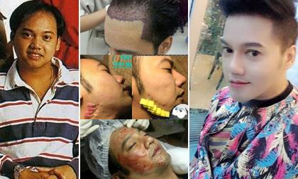 DJ Thái Lan tự tin khoe ảnh phẫu thuật thẩm mỹ