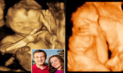 Những biểu hiện kỳ lạ của thai nhi trong bụng mẹ