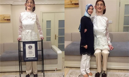 Cuộc sống của cô gái 17 tuổi 2,13 m - cao nhất thế giới 