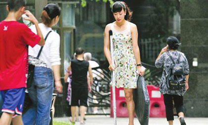 Nghị lực phi thường của cô gái một chân đi giày cao gót 20 cm