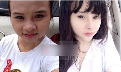 Gặp cô gái Hà Nội với màn lột xác kinh ngạc sau phẫu thuật thẩm mỹ
