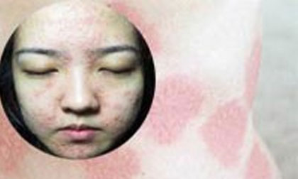 Rước bệnh vào thân khi giảm eo bằng rượu gừng nghệ