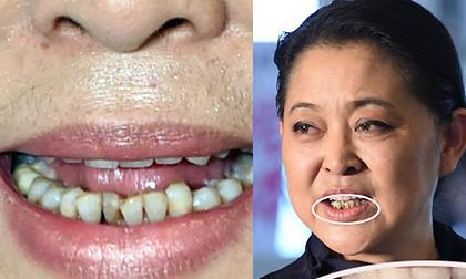 Sao nữ gạo cội lộ hàm răng ố vàng lởm chởm và ria mép như đàn ông