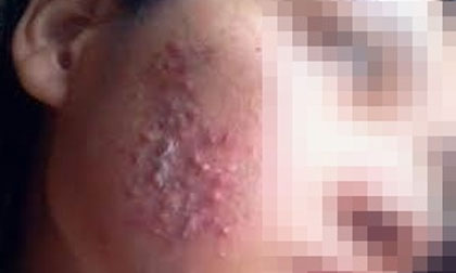 Lộ bằng chứng gian dối của thẩm mỹ viện bị tố làm hỏng mặt khách hàng