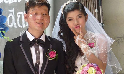 Người chồng trong bức ảnh cưới gây chấn động: "Đừng ác mồm nói cô ấy lấy tôi vì tiền hay để xuất ngoại"