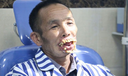 Phẫu thuật tái tạo gương mặt cho nạn nhân bị chó sói tấn công