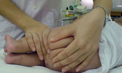 Tác dụng phụ nguy hiểm của thuốc hạ sốt đặt hậu môn