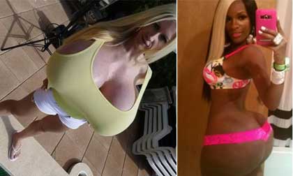 Choáng với những ca 'dao kéo' dị hợm nhất