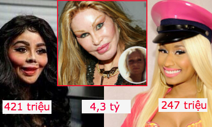 Những ngôi sao chi tiền không tiếc tay cho 'dao kéo'