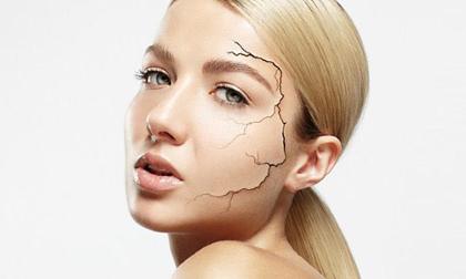 Dấu hiệu bất thường cảnh báo cơ thể mất nước trầm trọng