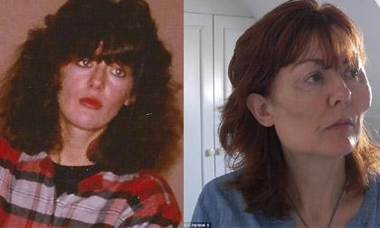 Ám ảnh kinh hoàng của người phụ nữ bị biến dạng mặt vì 'dao kéo'