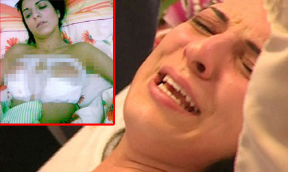 Sao truyền hình công khai ảnh phẫu thuật vòng 1 đau đớn