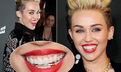 Những hàm răng dát vàng xa xỉ của sao Hollywood