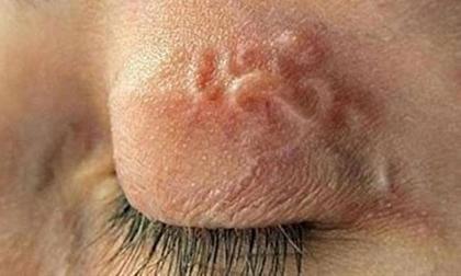 Kinh hoàng giun, sán ăn lục phủ ngũ tạng người