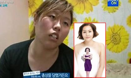 Thêm 1 ca thẩm mỹ khiến cả nước Hàn choáng váng