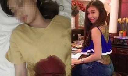 Sự thật vụ thiếu nữ 'đâm dao vào bụng tự tử' xôn xao dân cư mạng