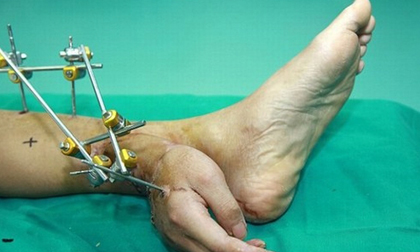 Những hiện tượng kỳ lạ khiến bạn 'rợn người'