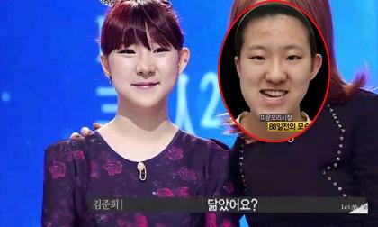 Cô gái có gương mặt biến dạng 'lột xác' sau phẫu thuật thẩm mỹ 