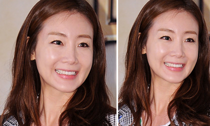 Choi Ji Woo lộ gương mặt cứng đơ thiếu tự nhiên