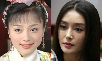 Mỹ nhân 'Hoàn Châu cách cách' lộ mặt cứng đờ vì thẩm mỹ?