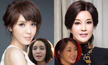 Gương mặt 'méo mó' của sao Hoa ngữ do di chứng 'dao kéo'