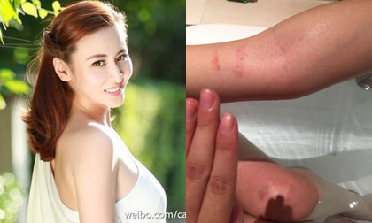 Sao nữ Hoa ngữ tung ảnh bị đạo diễn bạo hành dã man