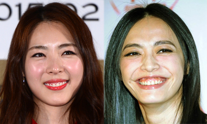 Những sao châu Á được khuyên nên biết tiết chế nụ cười