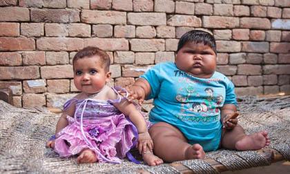 Aliya Saleem - cô bé 10 tháng tuổi có thân hình của trẻ 6 tuổi