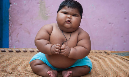 Tăng cân vùn vụt, bé 10 tháng nặng 18,7kg