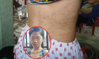 Thiếu nữ tố cáo bị cha mẹ nuôi đánh đập, cưỡng hiếp 6 năm ròng rã